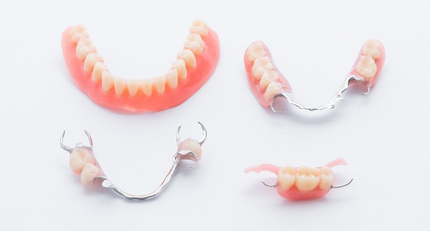 Opciones para dientes de reemplazo