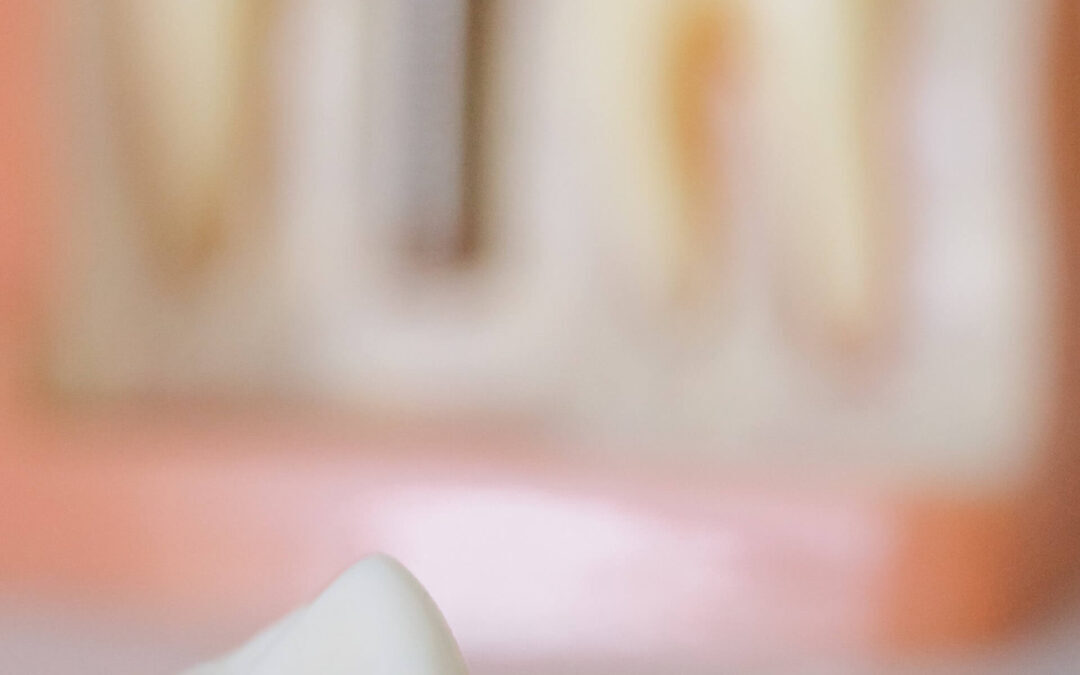 What’s The Best Crown for Your Tooth?