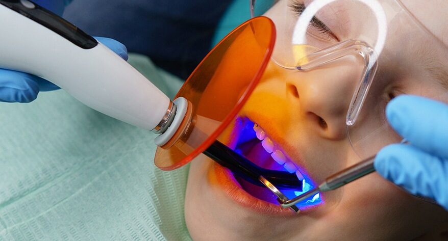 Selladores dentales para ni&ntilde;os