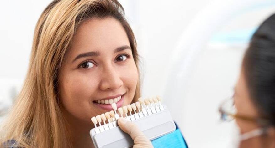 Veneers FAQs
